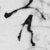 𡨸共