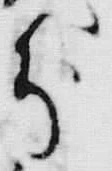 「被」字