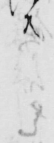 𡨸共