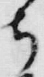 “ち”字